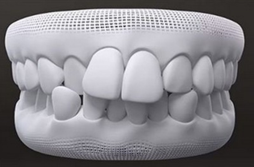 Invisalign: A Process That Helps You to Enjoy Eating