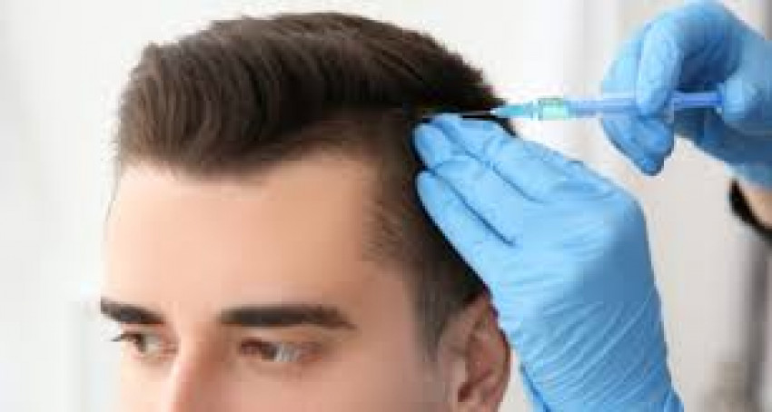 Hair Transplant Surgery in Lucknow, For a Gorgeous Look
