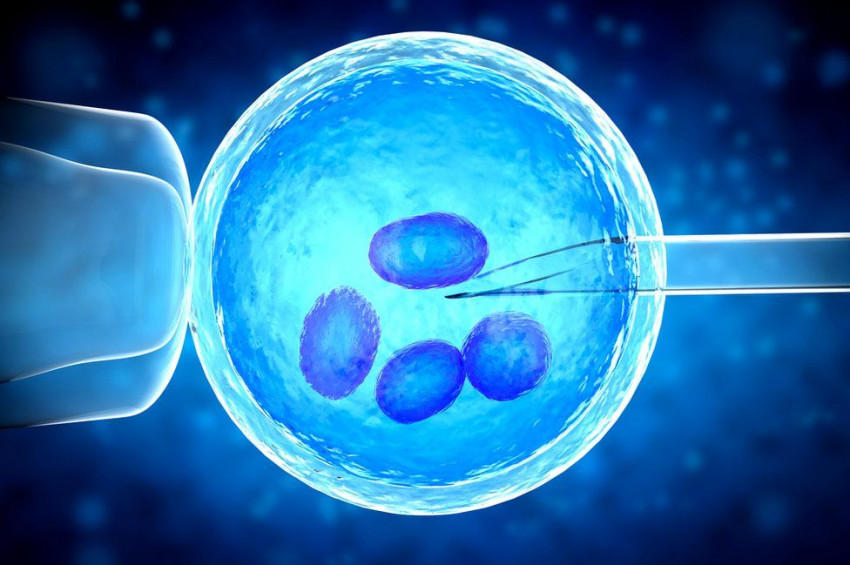 IVF Treatment in Pakistan In Vitro Fertilization (IVF)