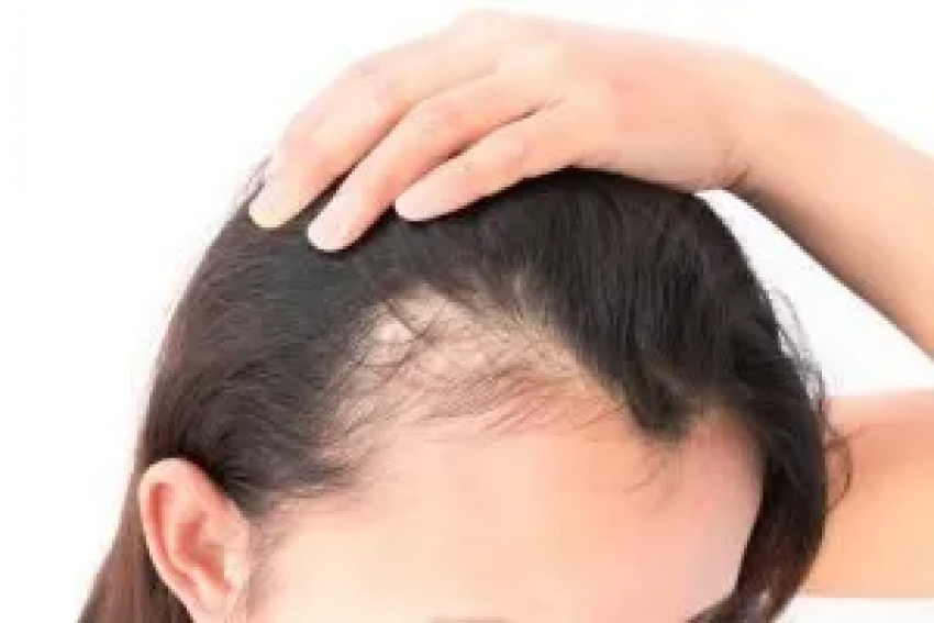 Folliculitis and Hair Loss   hair loss treatment