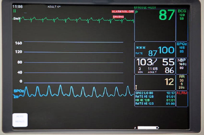 The main points of Patient Monitor operation that you must master