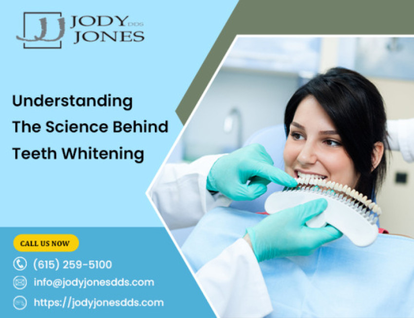 Understanding The Science Behind Teeth Whitening