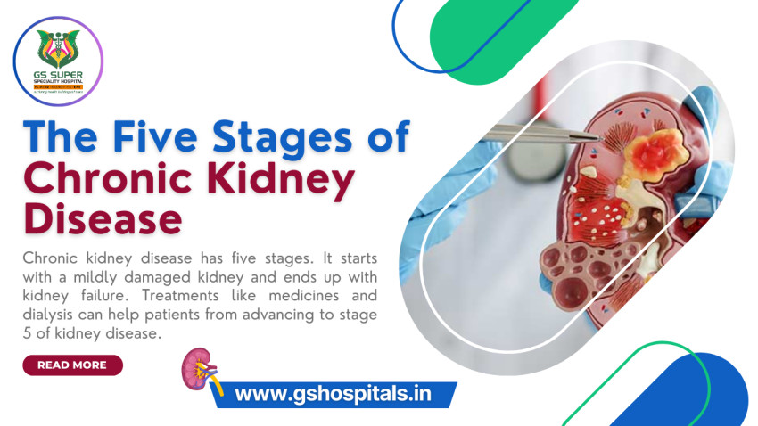 The Five Stages of Chronic Kidney Disease