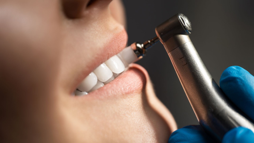 The Importance of Scheduling a Routine Dental Cleaning in Riverside, CA
