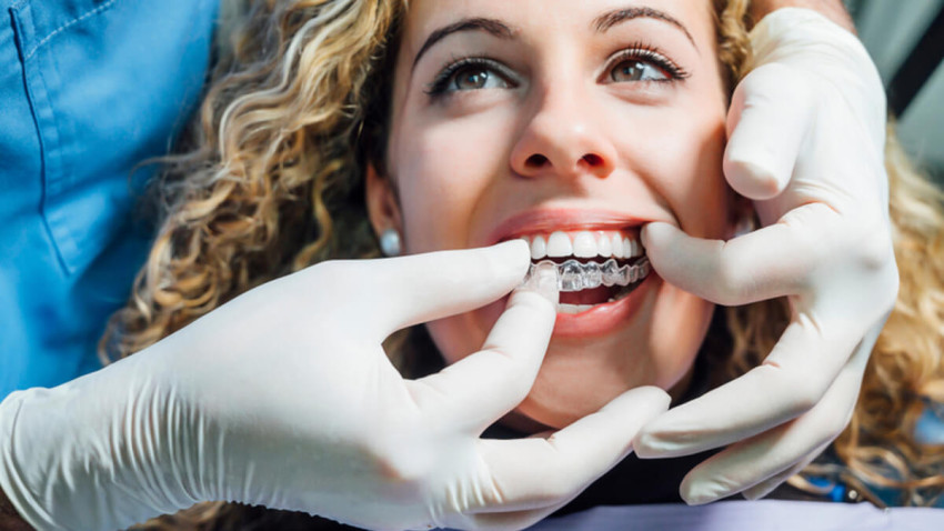 The Science Behind Invisalign: How It Works in Grande Prairie