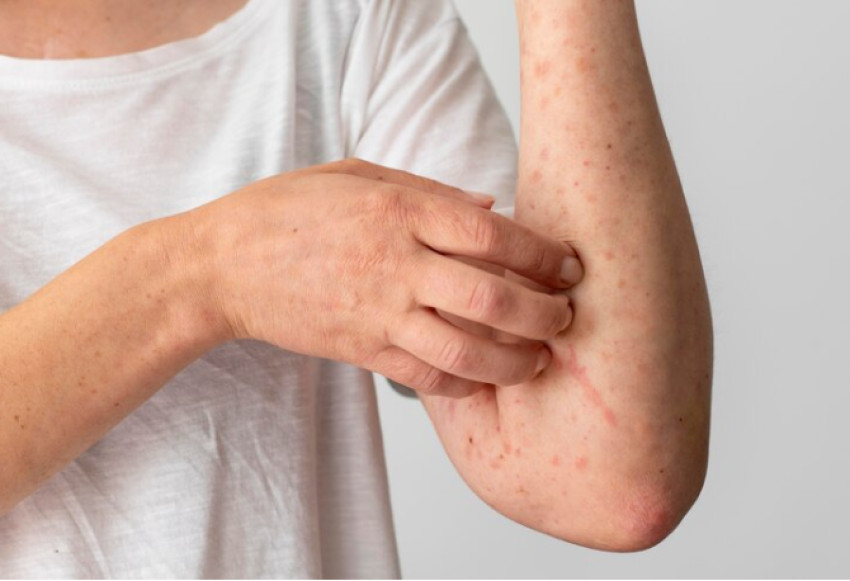 How Can Dermatologist Help with Skin Allergies and Rashes?