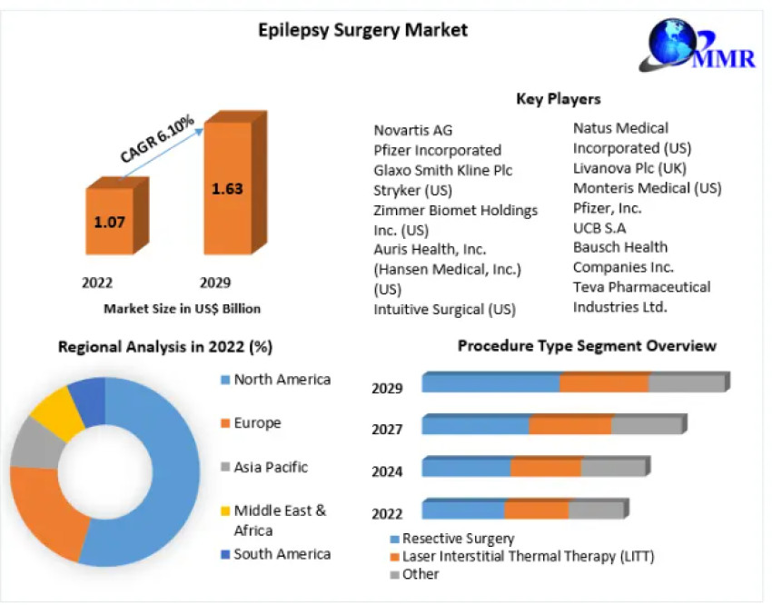 Epilepsy Surgery Market Revenue, Growth, Developments, Size, Share and Forecast 2029