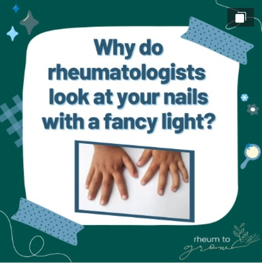 Pediatric Rheumatology In Houston, Texas: Finding The Right Care