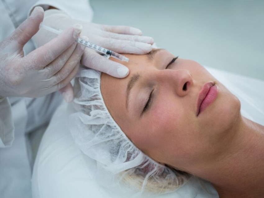 4 Questions to Ask before Anti Wrinkle Injectables in Sydney