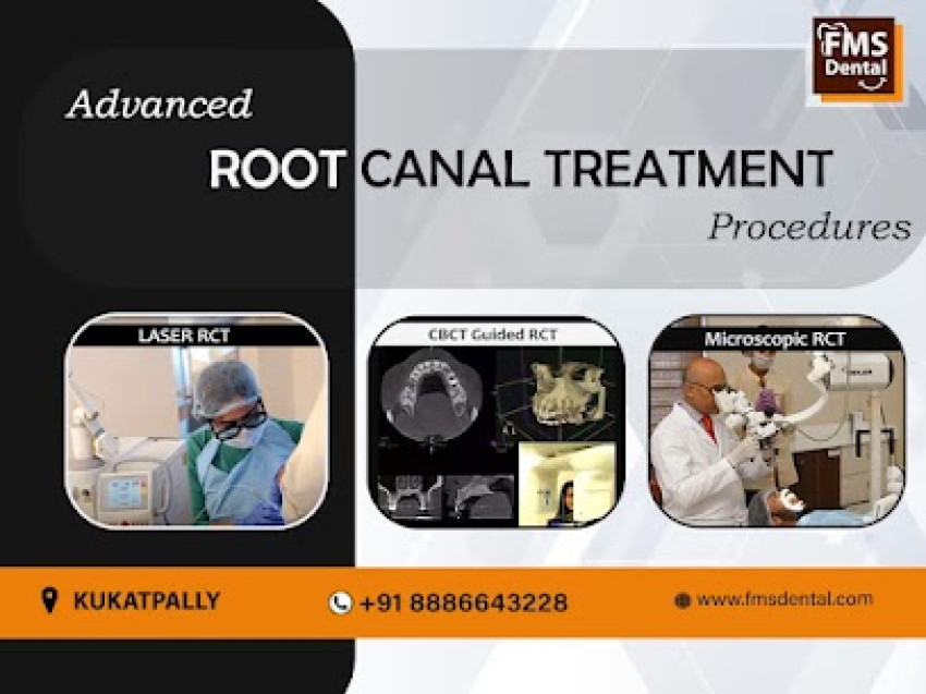 The Effectiveness of Single Sitting RCT in Hyderabad by FMS Dental Hospital