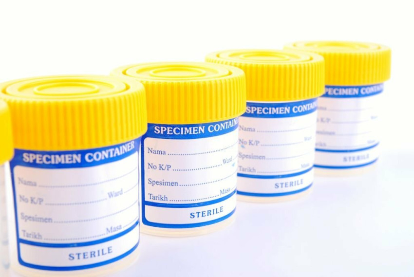 Navigating Drug Testing Regulations: A Guide for Employers