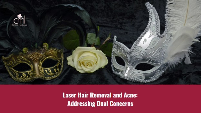 Laser Hair Removal and Acne: Addressing Dual Concerns