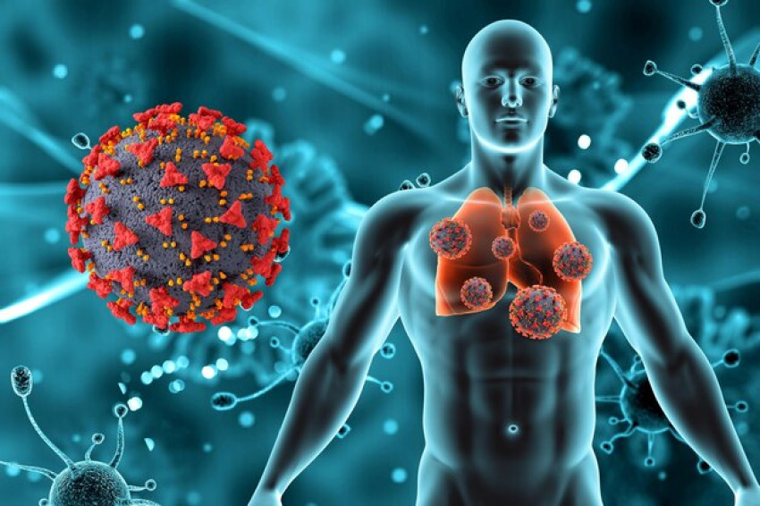 Non-Small Cell Lung Cancer Explained: Everything You Need to Know