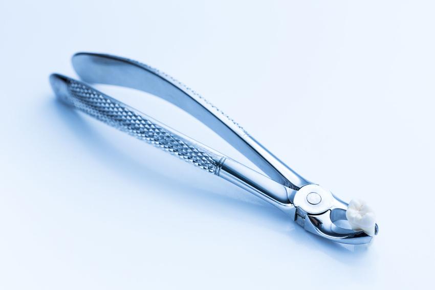 Tooth Extraction Made Easy: A Complete Patient Guide