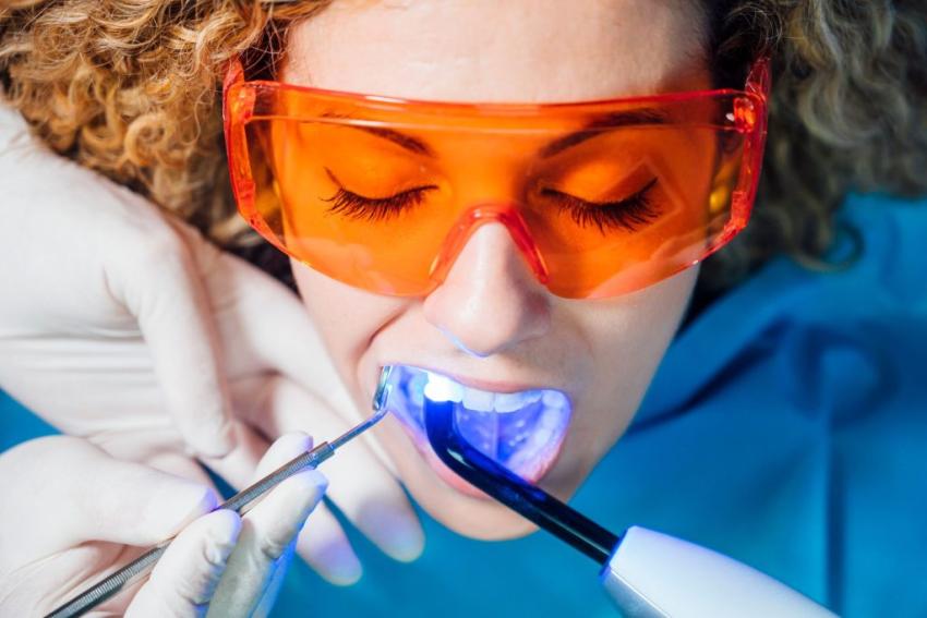 Teeth Whitening in Norwich: Get That Beautiful Smile Today