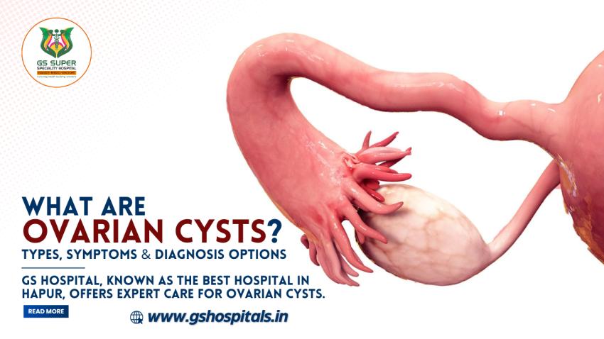 What are Ovarian Cysts: Types, Symptoms & Diagnosis Options
