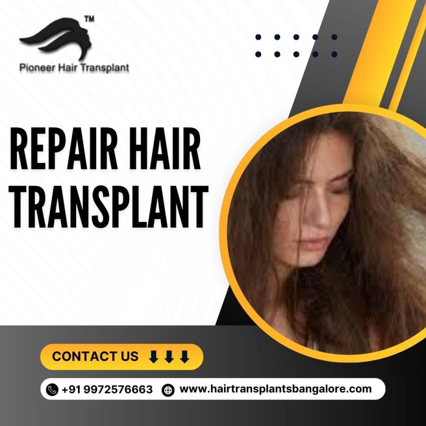 Repair Hair Transplant in Bangalore | Hair Transplant