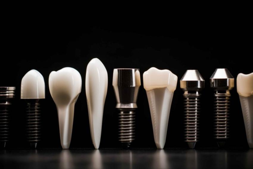 Dental Implants Norwich Why You Need it | PearlDentalSurgery