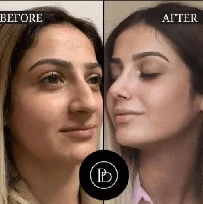 My Experience with the Best Doctors in Dubai – Before & After