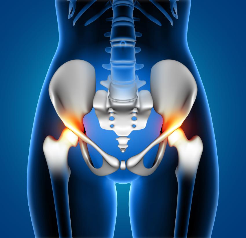 Hip Replacement Surgery in India: What You Should Know