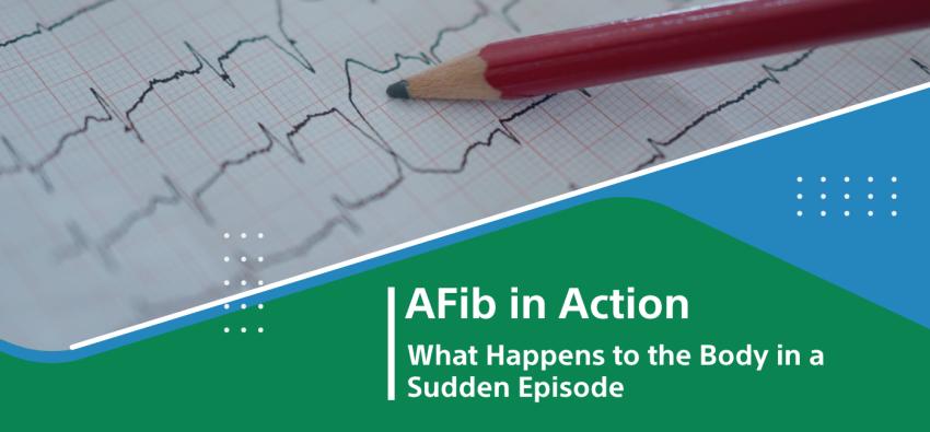 Atrial Fibrillation in Action: What Happens to the Body in a Sudden Event