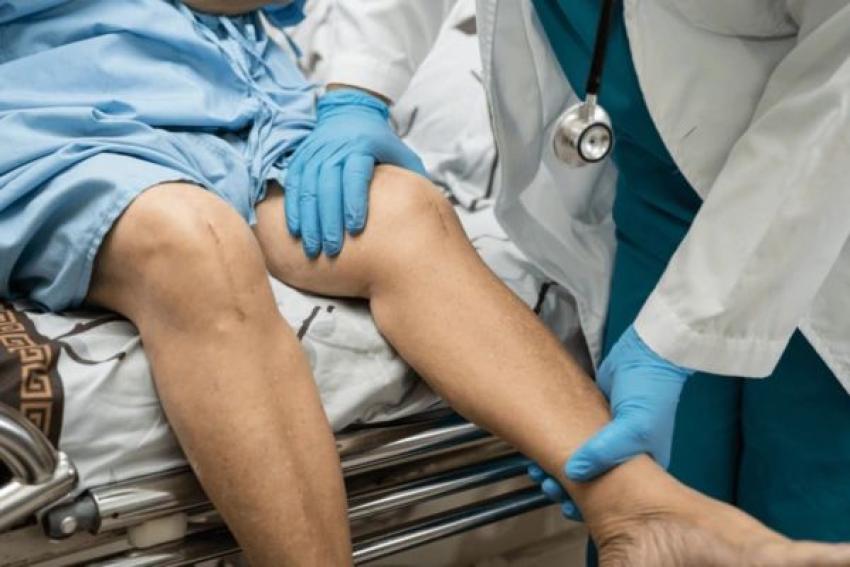 Best Revision Joint Replacement in Ahmedabad | Expert Care