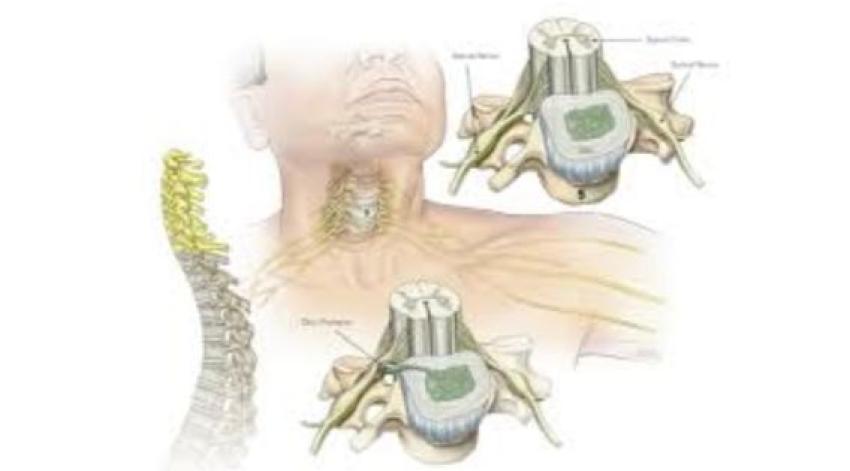 Cervical Spine Neurosurgery in Kolkata: Advanced Solutions for Neck Pain