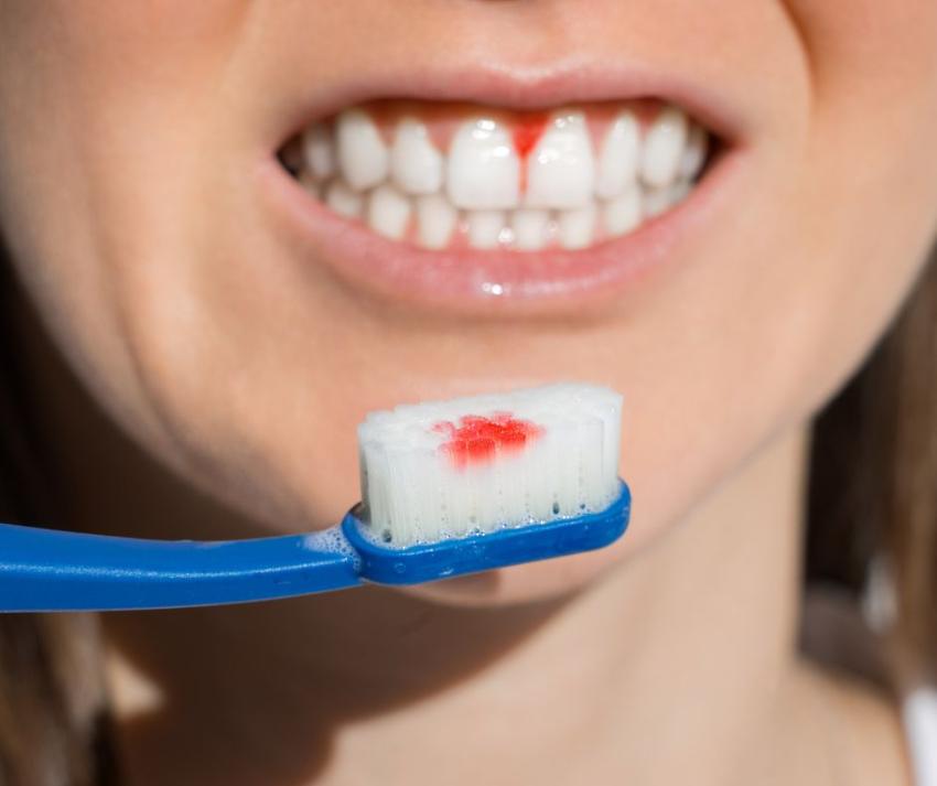 Advance Gum Care: Simple Steps That Actually Help