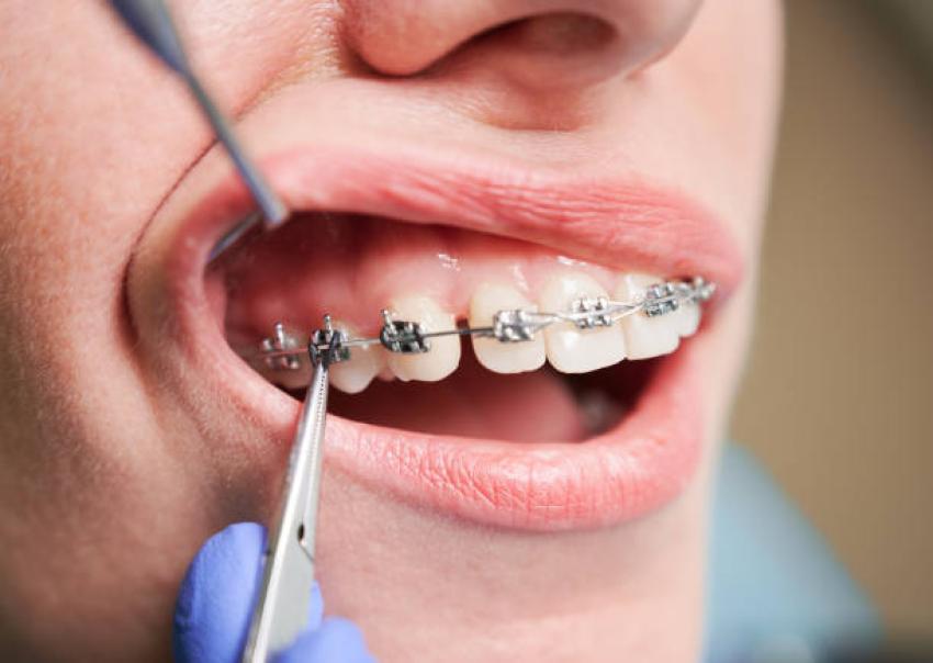 How Modern Orthodontic Care Is Transforming Smiles and Oral Health