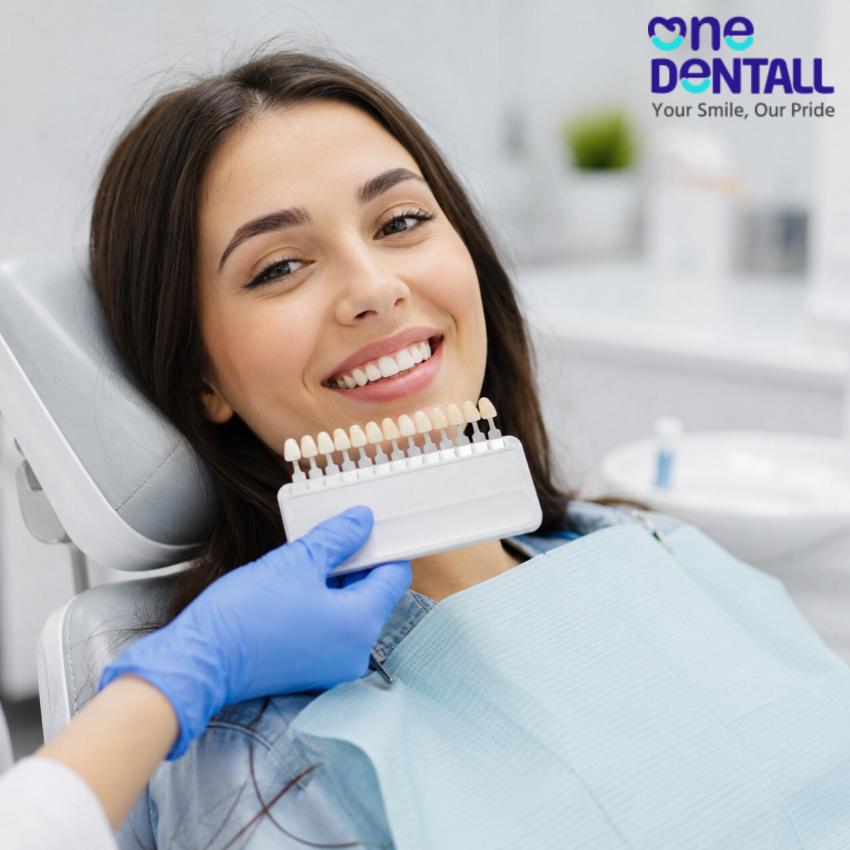 Teeth whitening services near me in Belgaum with discounts or promotions