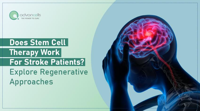 Does Stem Cells for Stroke Works? Explore Regenerative Approaches