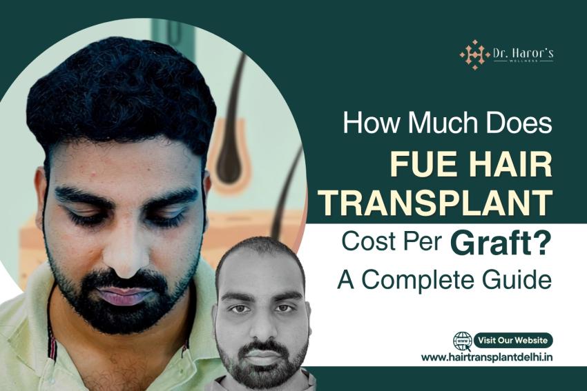 FUE Hair Transplant Cost Per Graft: What You'll Actually Pay in 2026