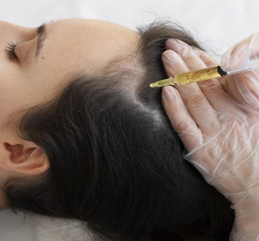 Hair Transplant in Dubai: Understanding the Healing Timeline