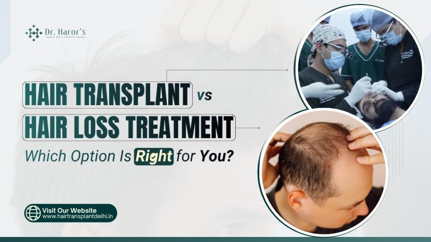 Hair Transplant vs Hair Loss Treatment: Which Option Is Right for You