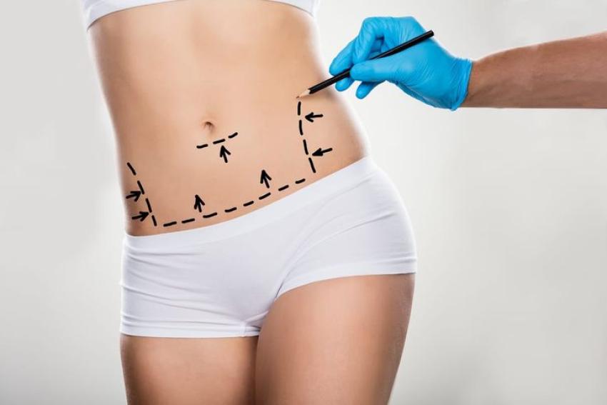 Liposuction in Dubai: Maintenance and Long-Term Care