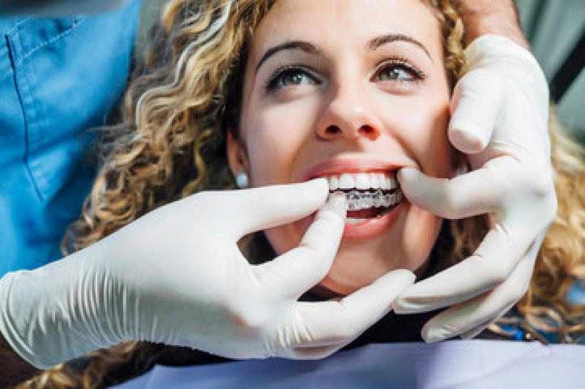 Important things to know before starting clear aligner treatment